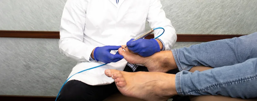 Aplicación de un dispositivo láser sobre las uñas del pie